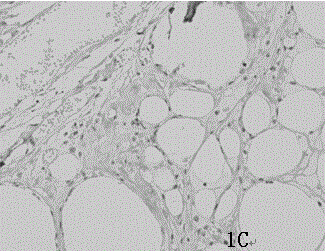 Preparation method of biological scaffold material and SVF assistant adipose tissue