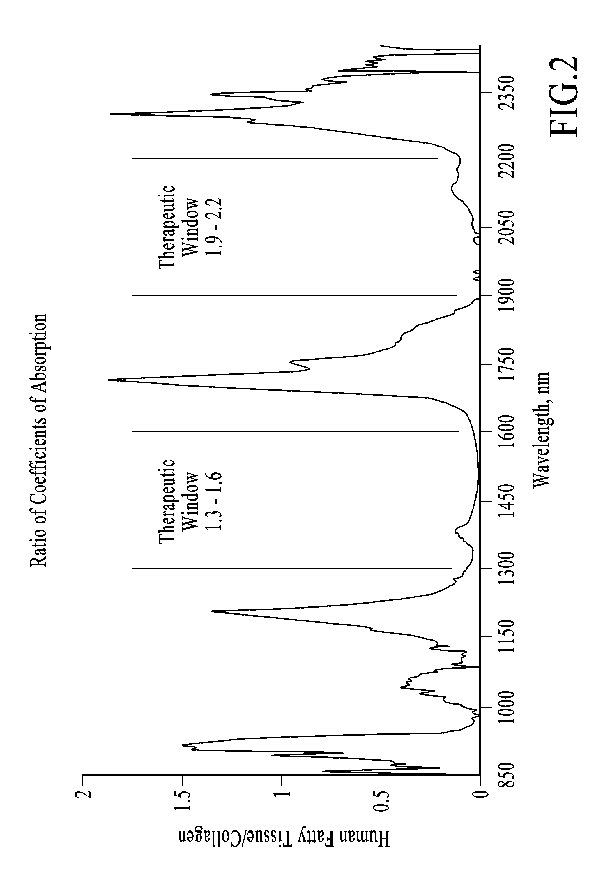 Thermally mediated tissue molding