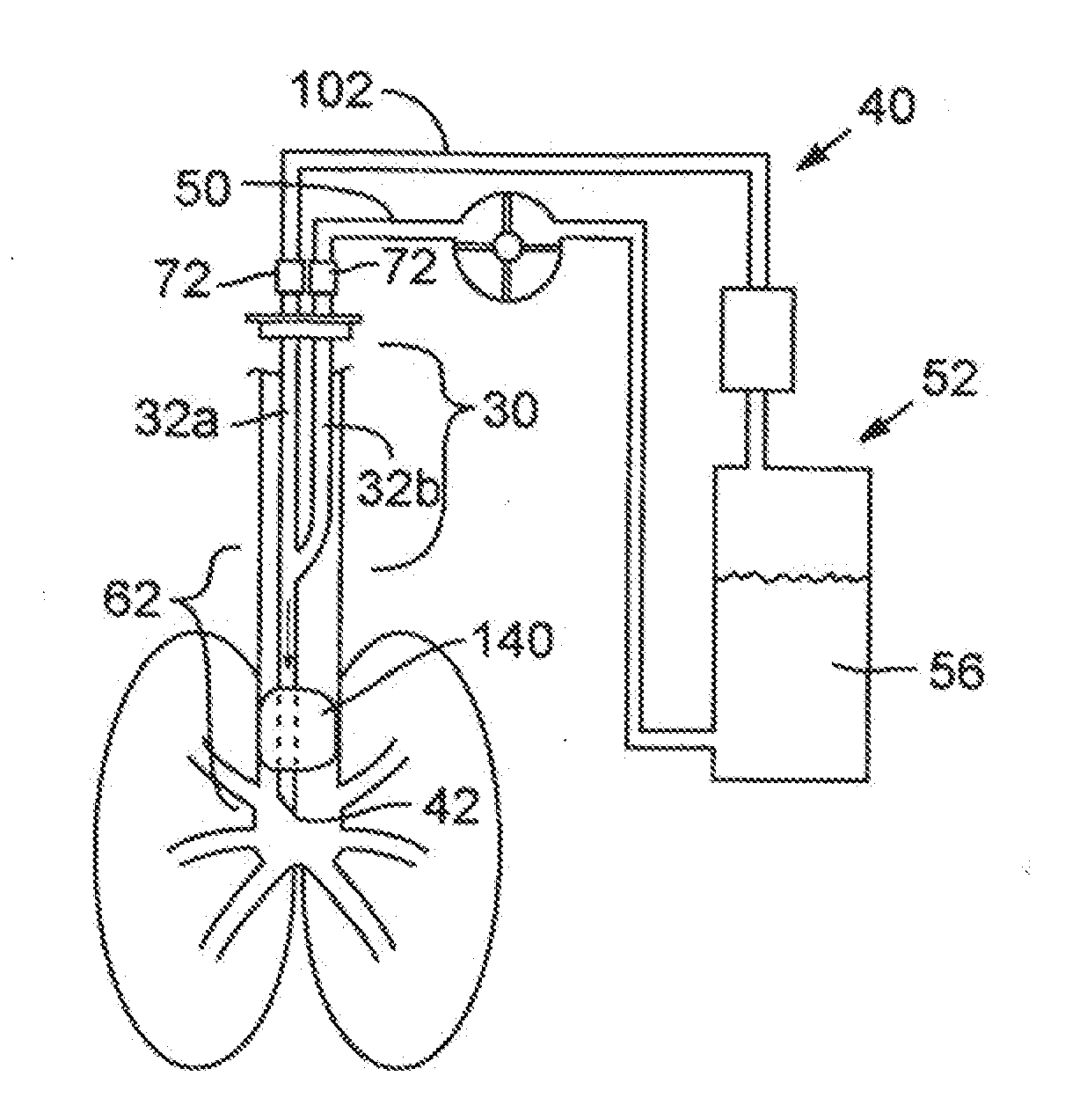 Secretion clearing ventilation catheter and airway management system
