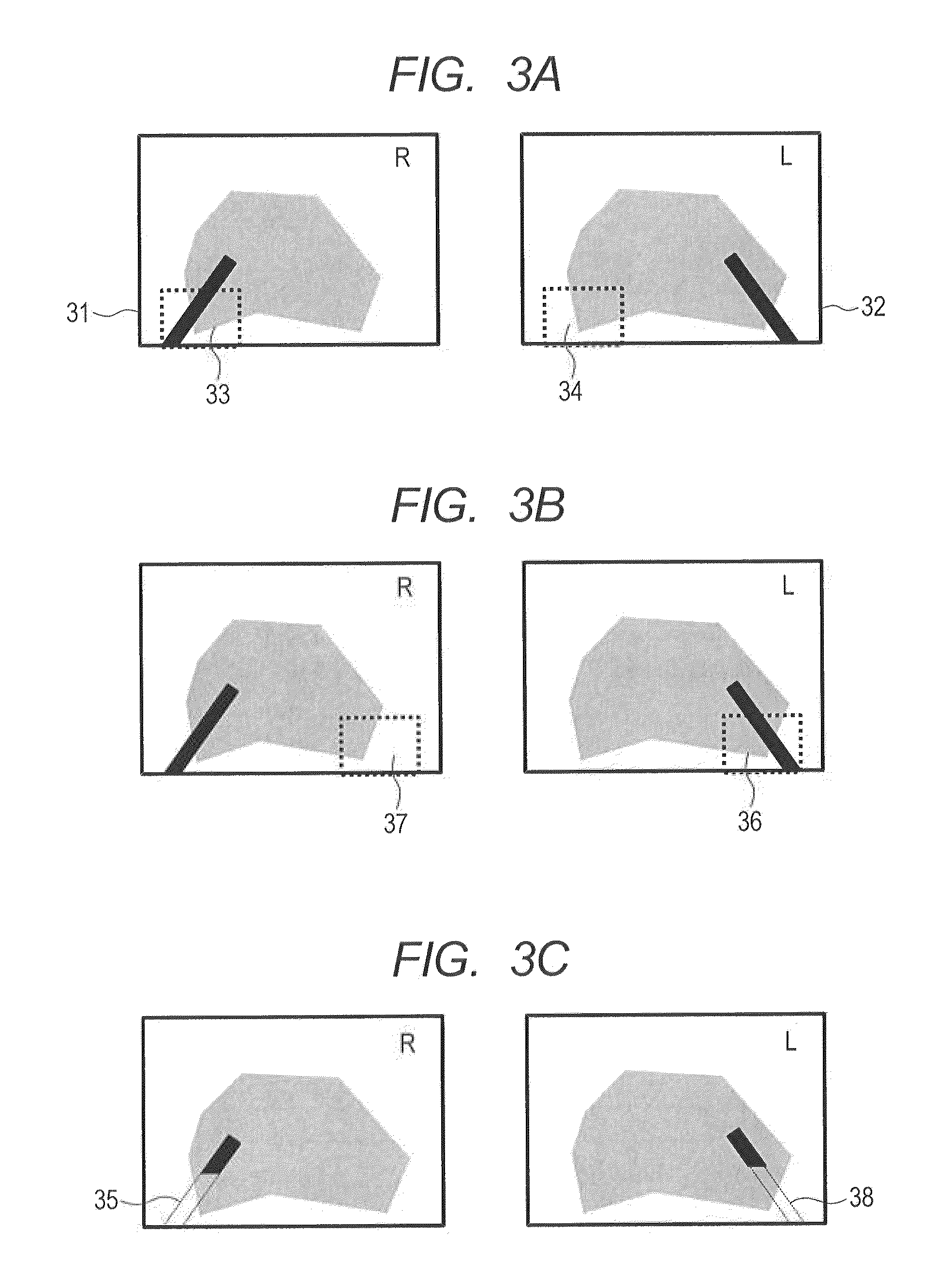Stereo endoscope apparatus and image processing method