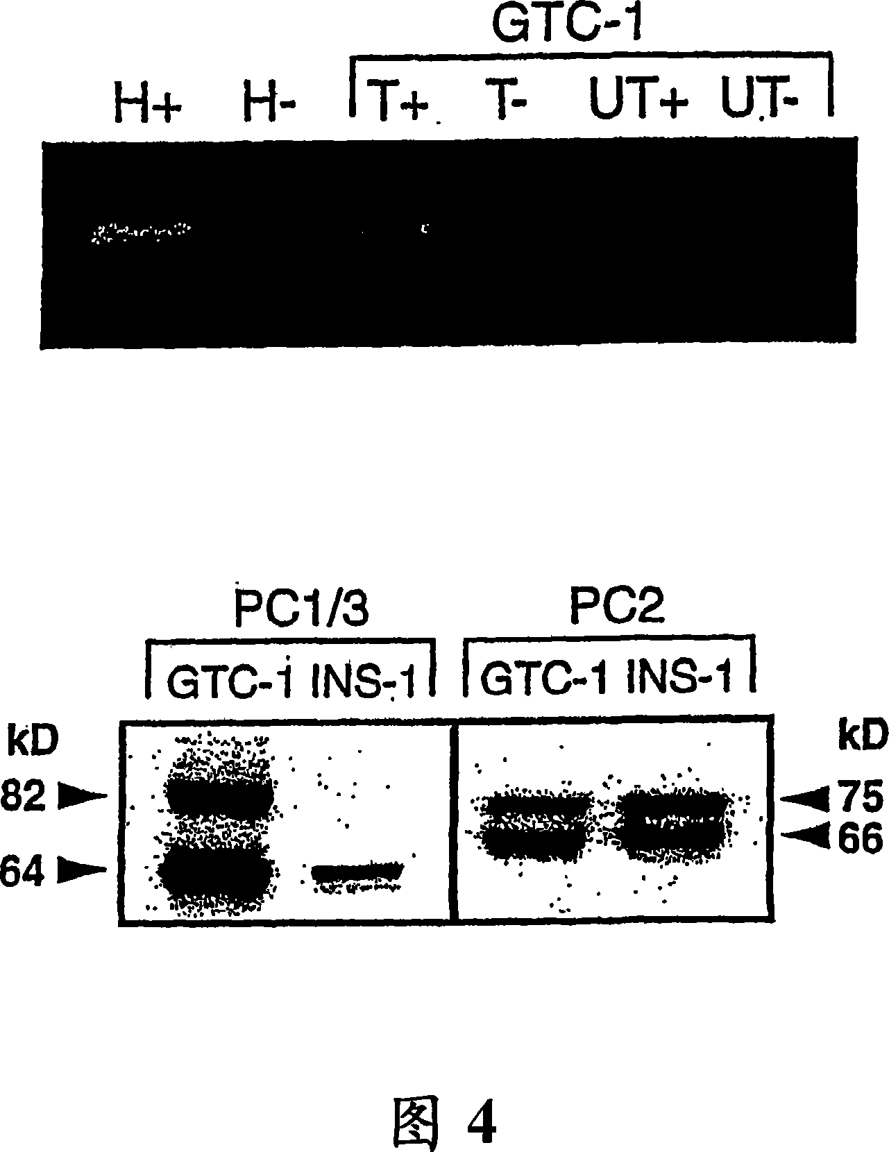 Compositions and methods for regulated protein expression in gut