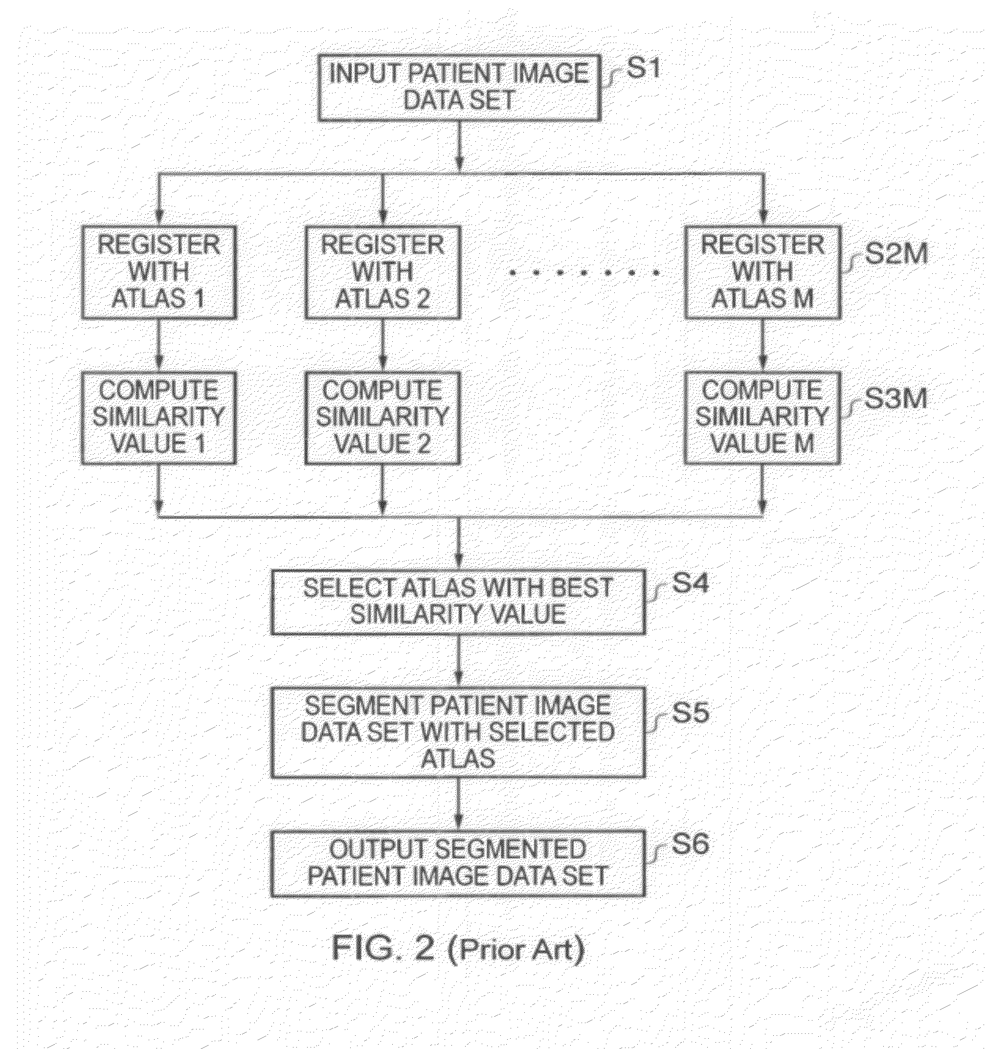 Image segmentation