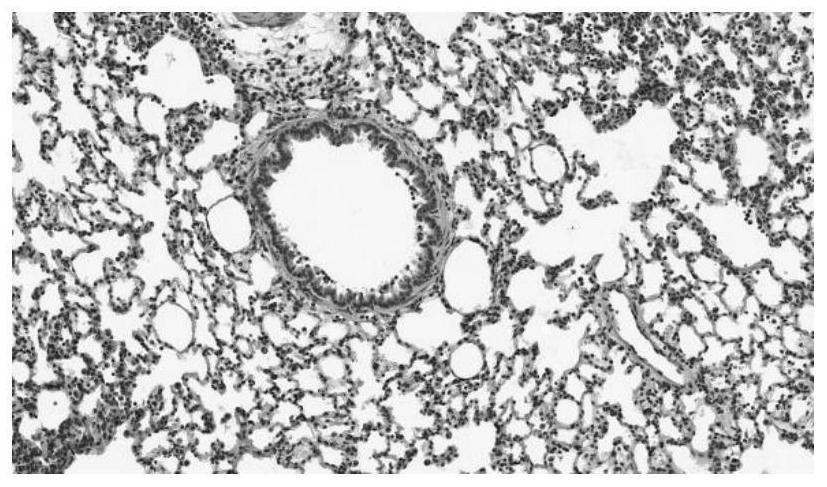 Stable-phase series traditional Chinese medicine prescription for treating chronic obstructive pulmonary disease and application