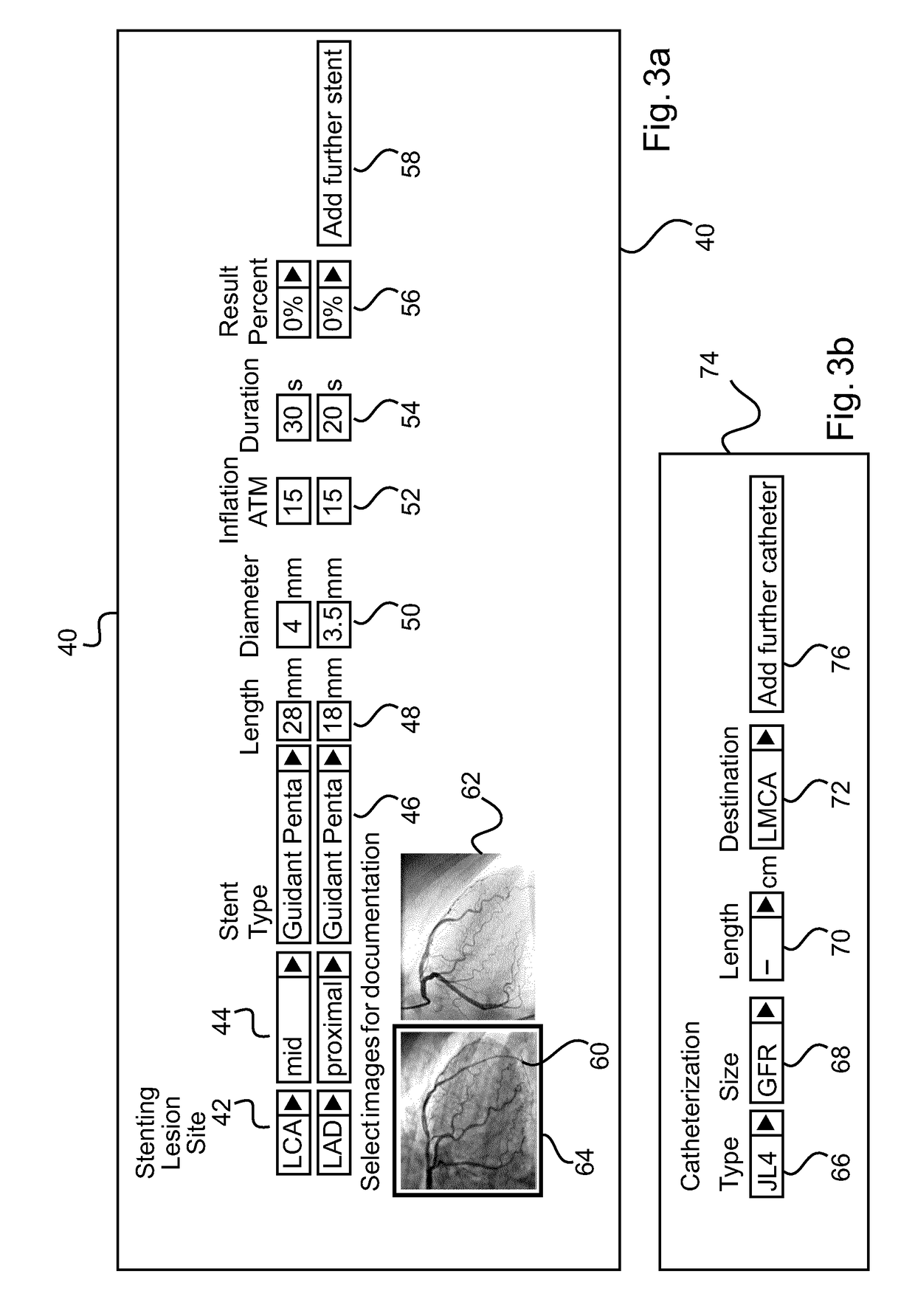 Interventional medical reporting apparatus