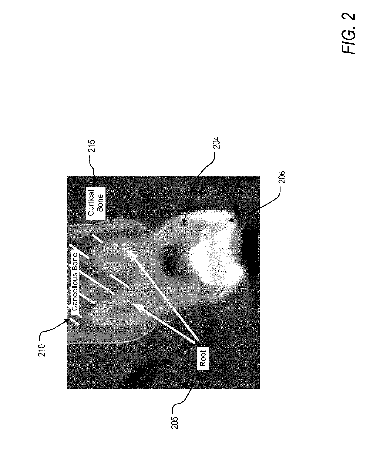 Method and system of teeth alignment based on simulating of crown and root movement