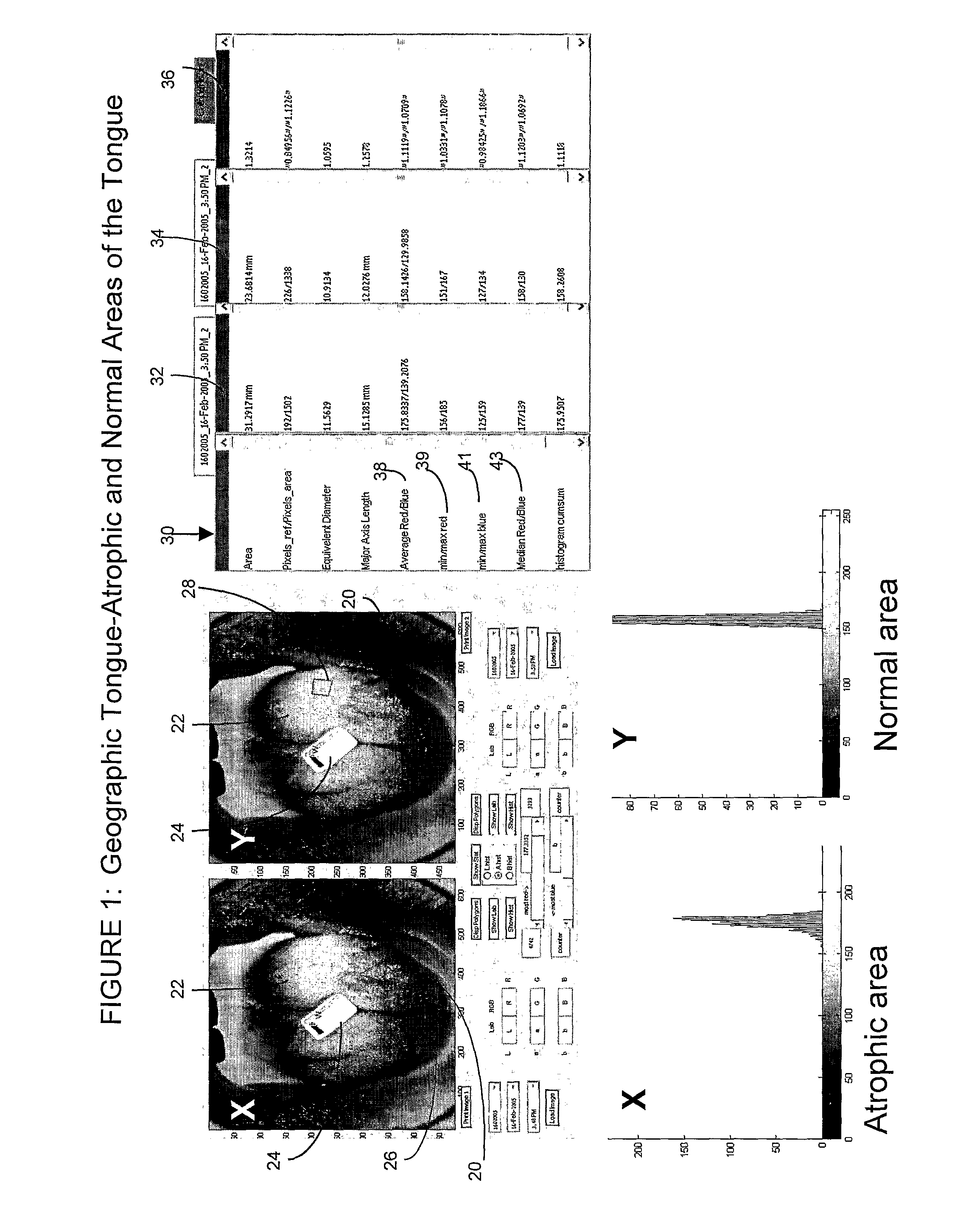 Medical Imaging Method and System