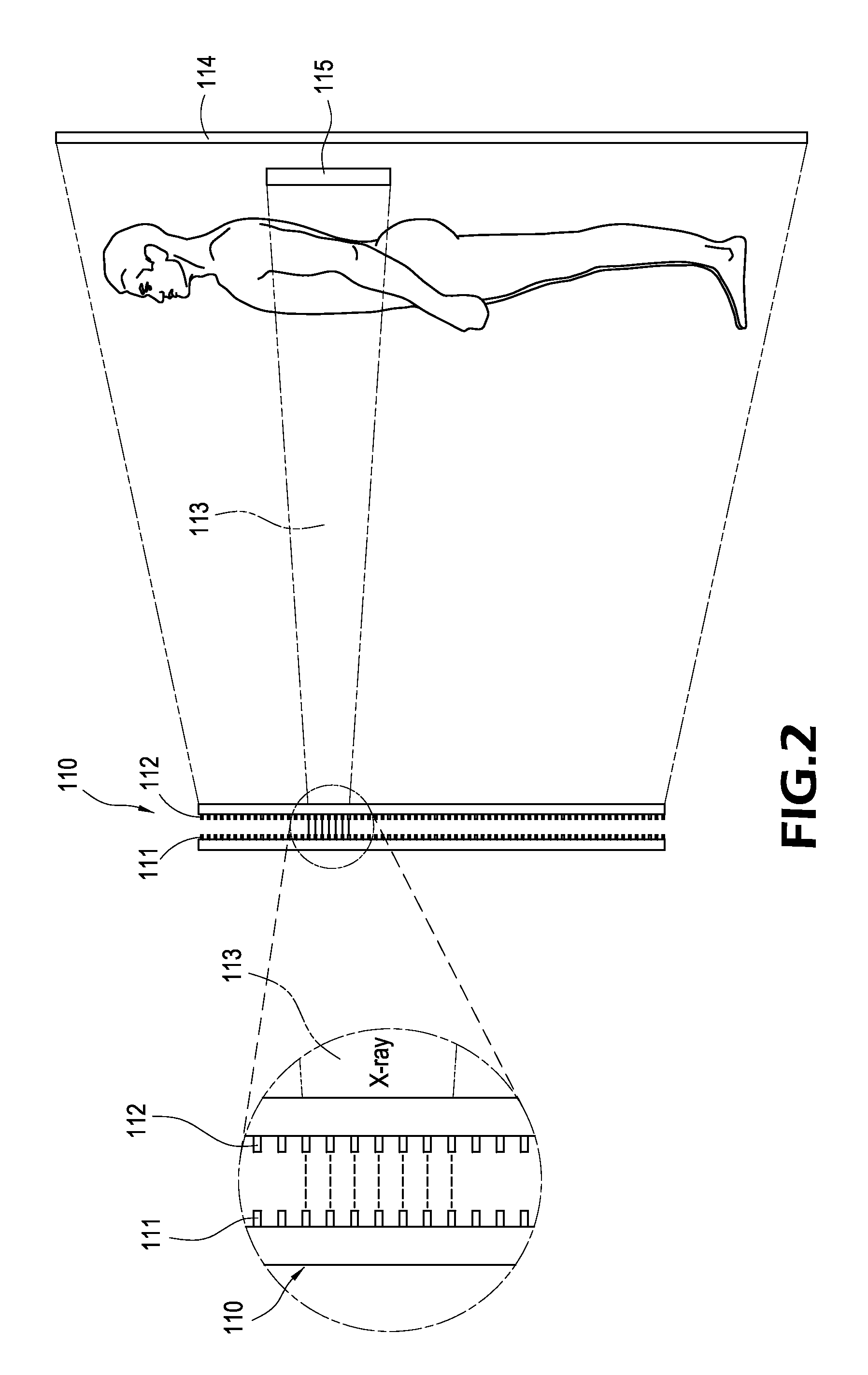 Method and apparatus for controlling x-ray machine to irradiate a narrowed portion