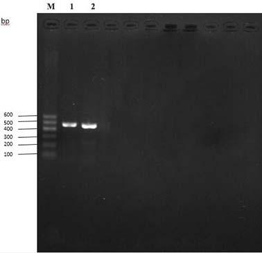 Construction and application of tubercle bacillus Pup gene deletion mutation strain