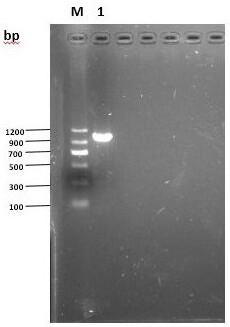 Construction and application of tubercle bacillus Pup gene deletion mutation strain