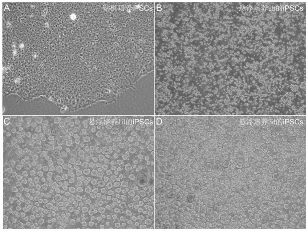 Culture solution for preparing pancreatic beta cells by inducing directional differentiation of pluripotent stem cells