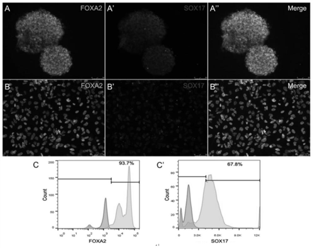Culture solution for preparing pancreatic beta cells by inducing directional differentiation of pluripotent stem cells