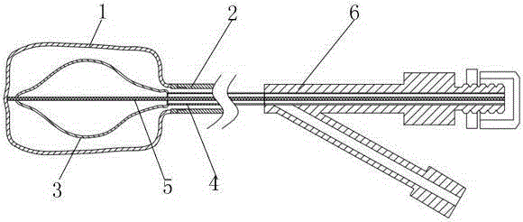 Adjustable high-pressure-expansion balloon bag