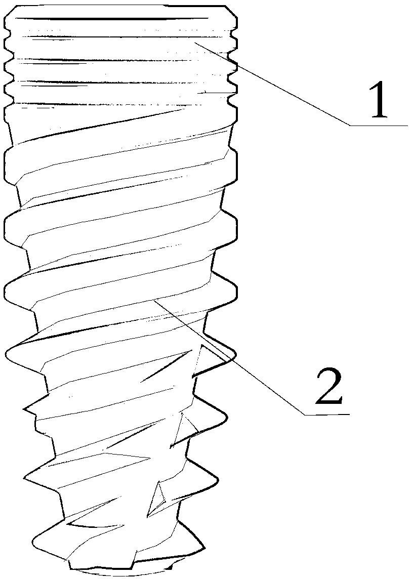 Dental department implant and method for verifying binding ability of dental department implant to bone