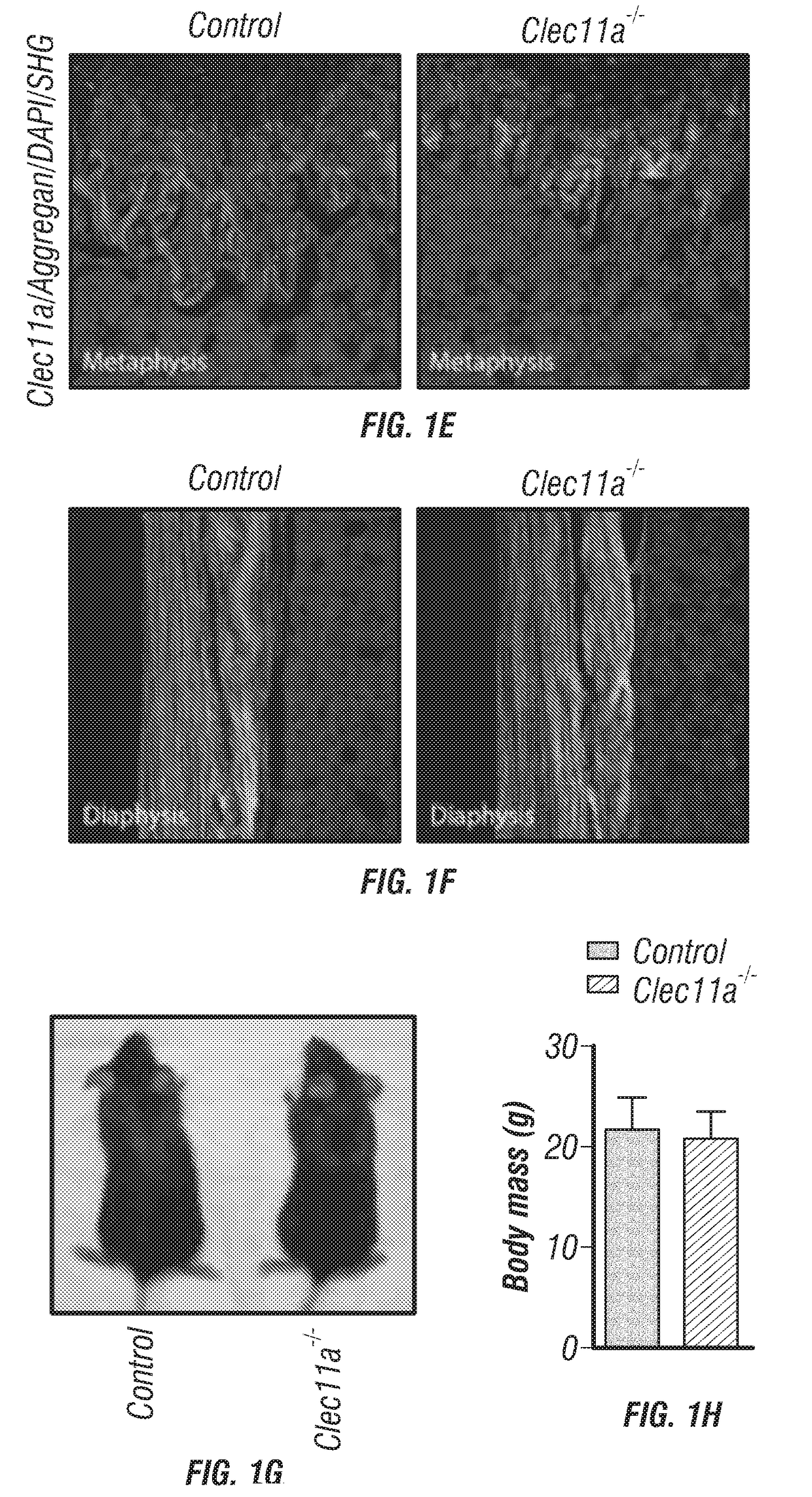 Clec11a is a bone growth agent