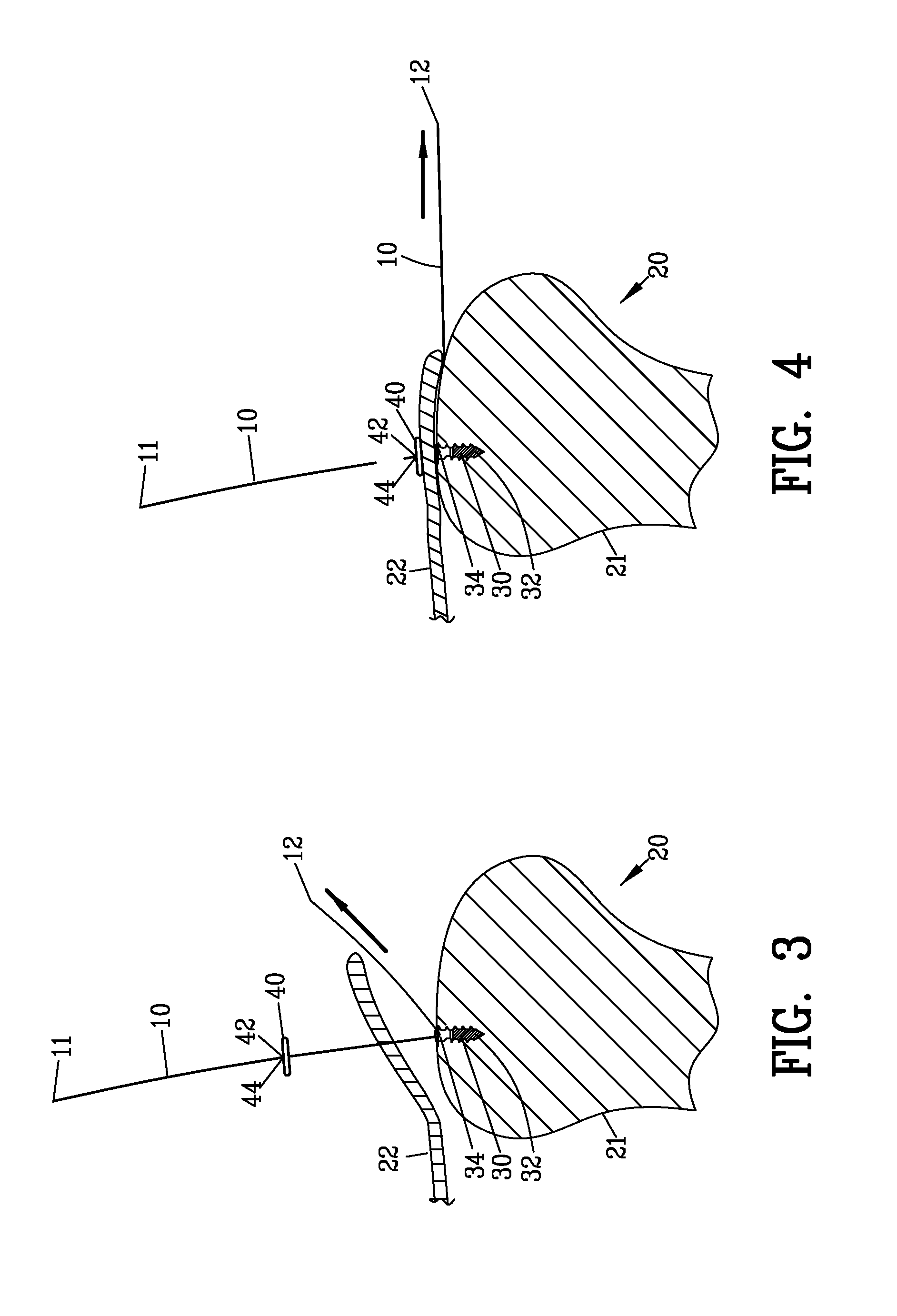 apparatus-and-method-for-securing-flexible-member-eureka-patsnap