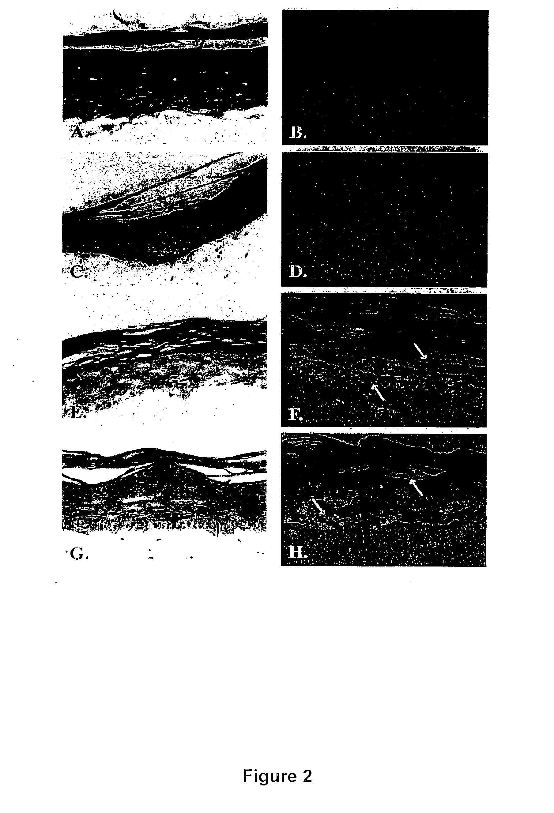 Method and composition for skin grafts
