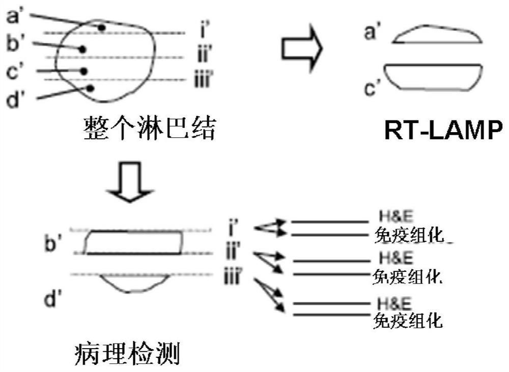 A set of lamp primers ck19-33 for rapid detection of lymph node metastasis in head and neck squamous cell carcinoma