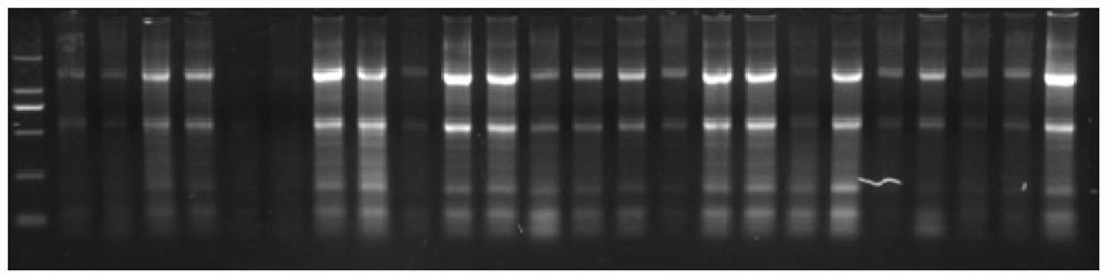 A set of lamp primers ck19-33 for rapid detection of lymph node metastasis in head and neck squamous cell carcinoma