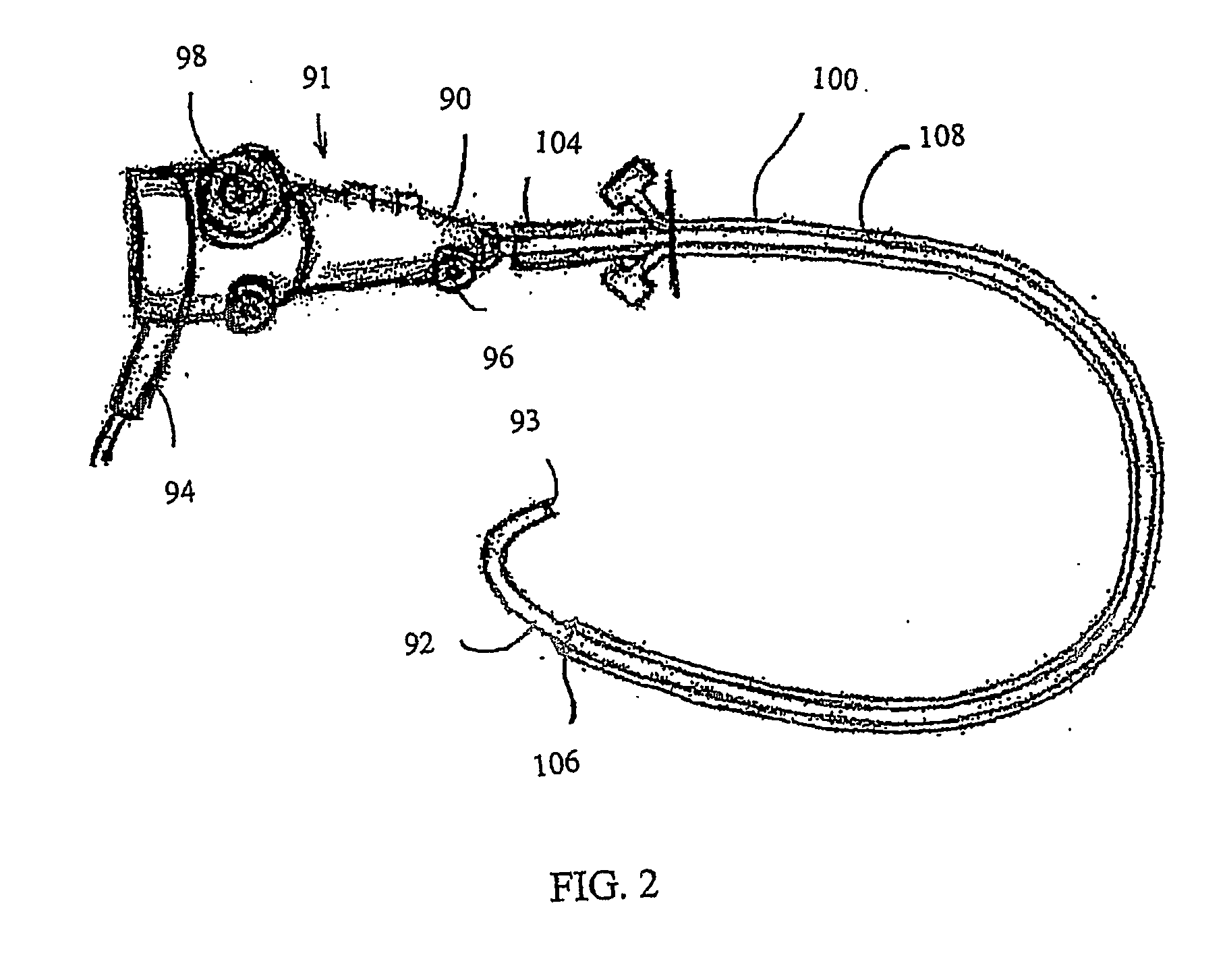 Apparatus and method for colonoscopic appendectomy