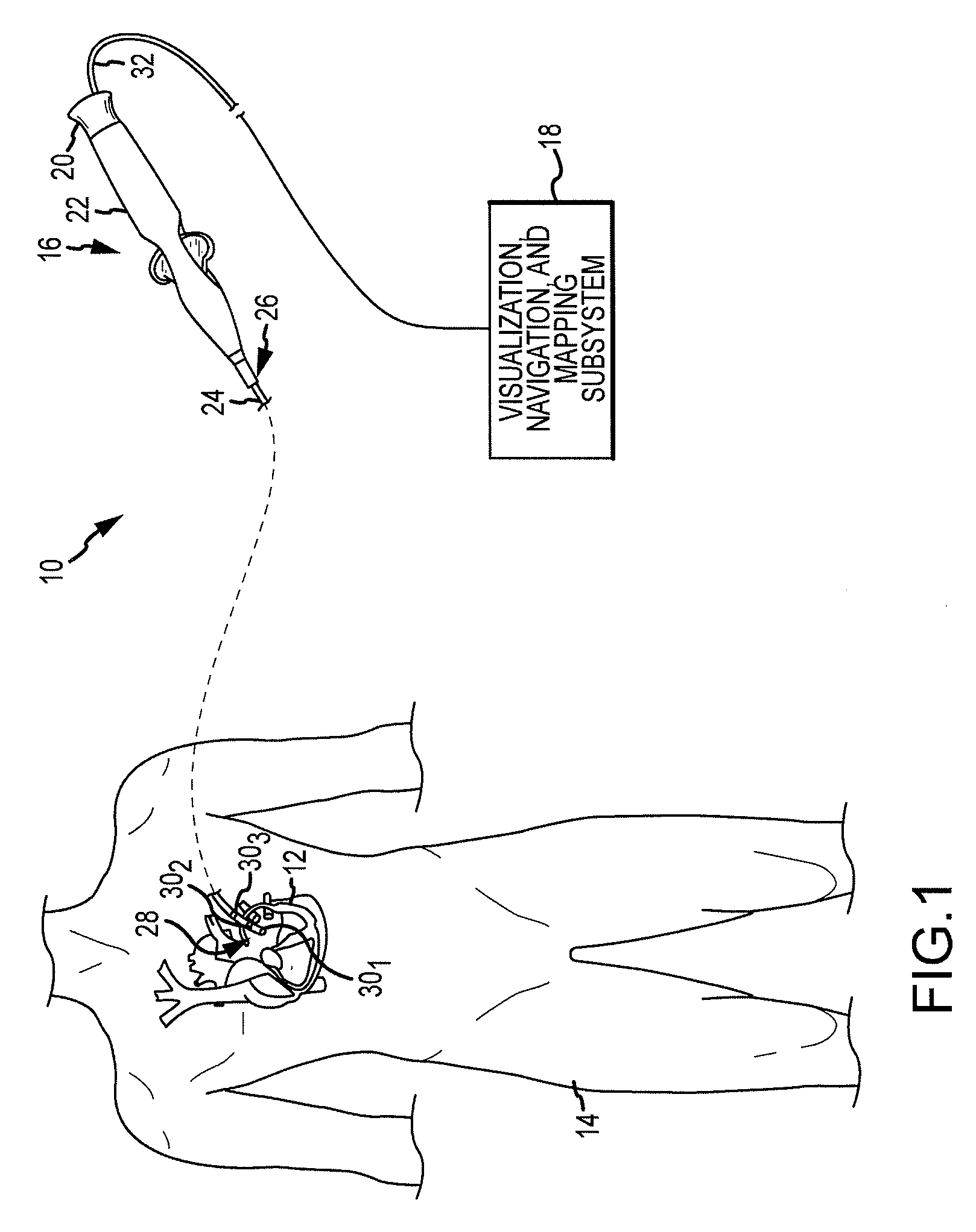 System and method for diagnosing arrhythmias and directing catheter therapies