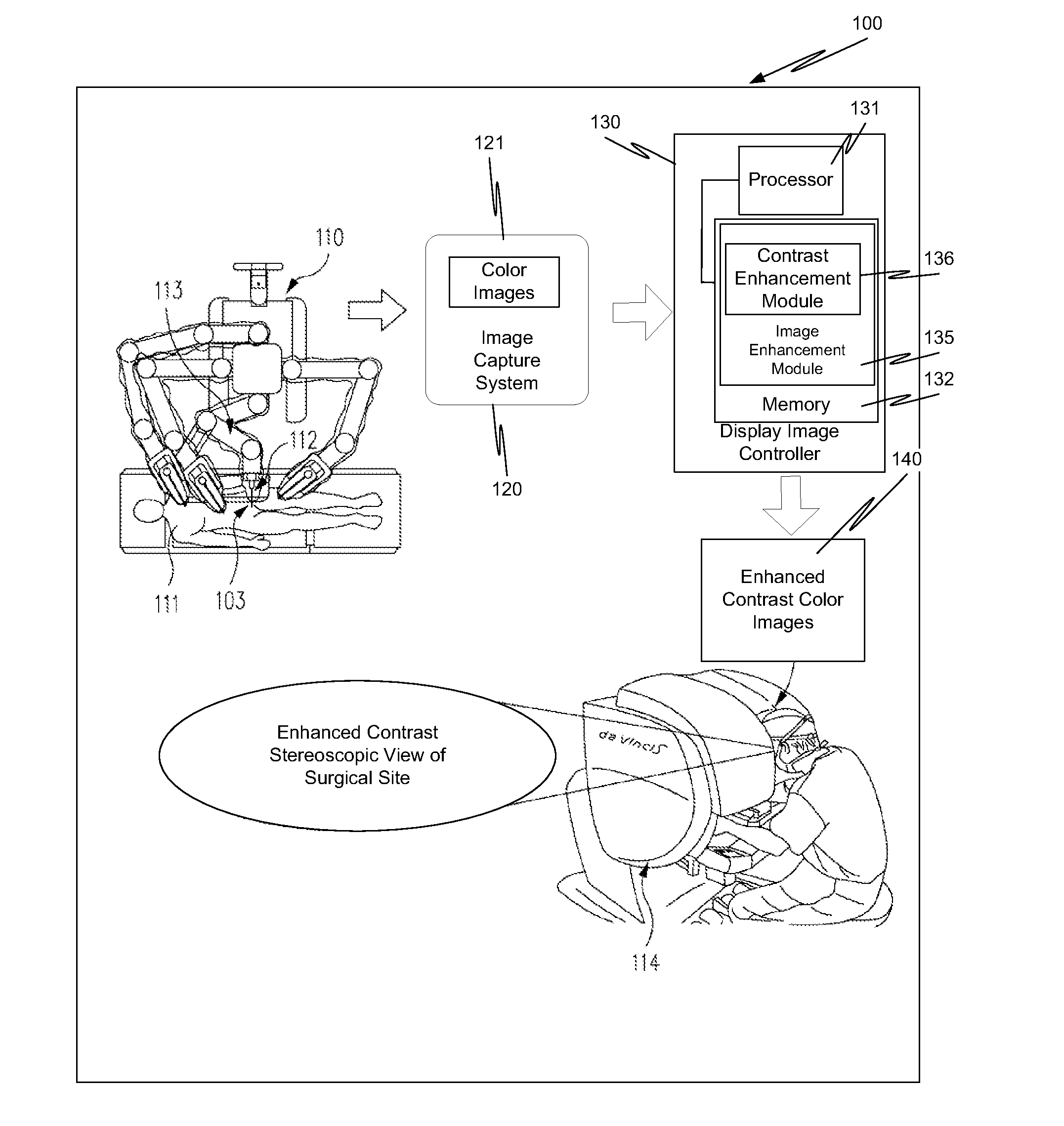 Method and structure for image local contrast enhancement