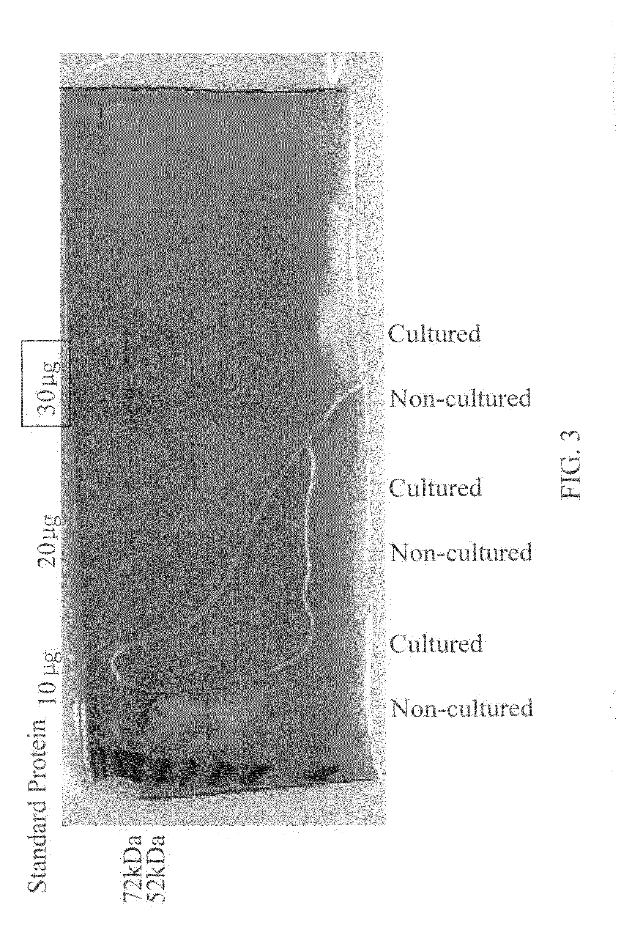 Fetuin-beads, Manufacturing method thereof and method of concentrating and detecting influenza virus by the same