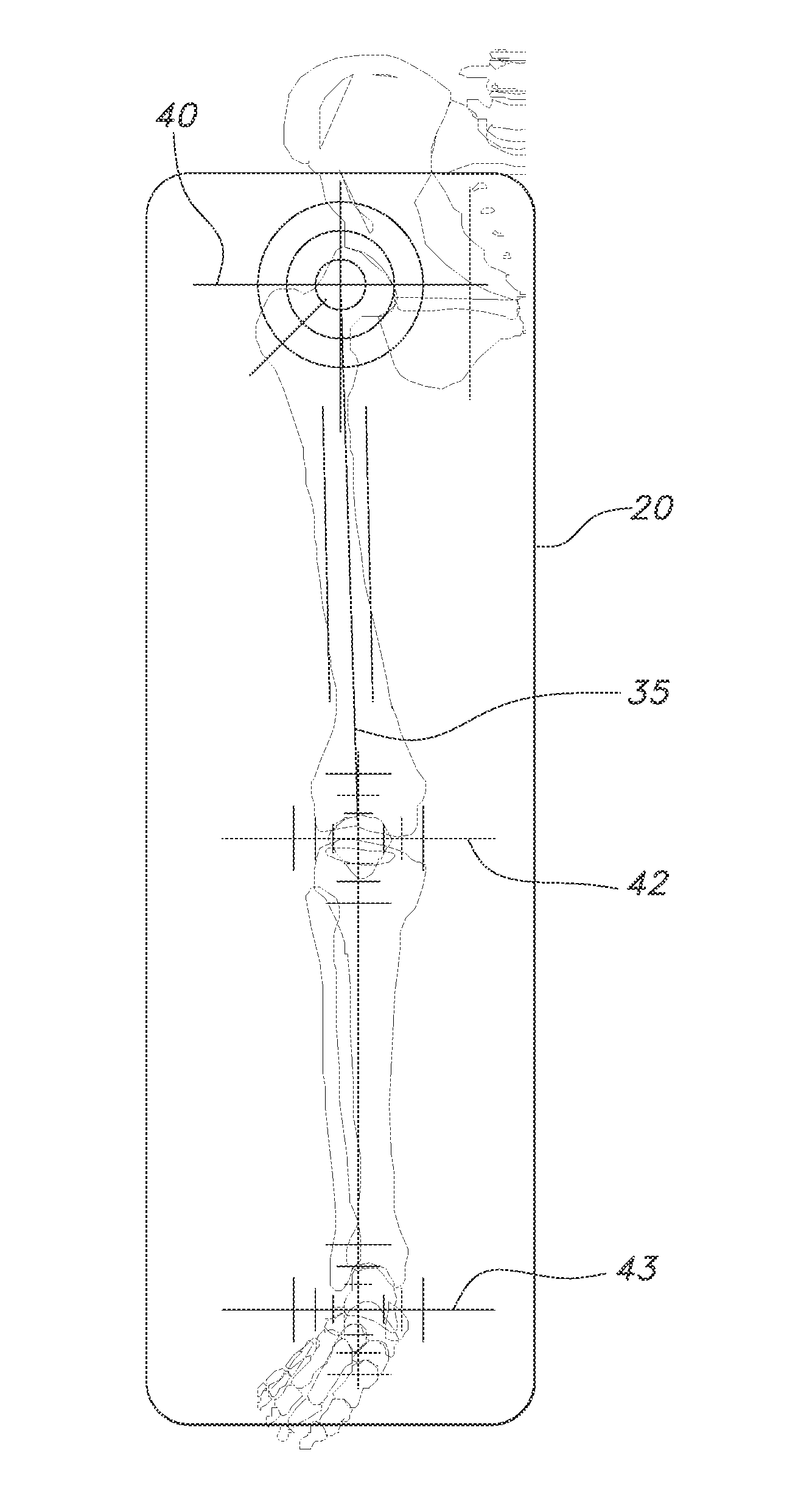Alignment plate apparatus and system and method of use