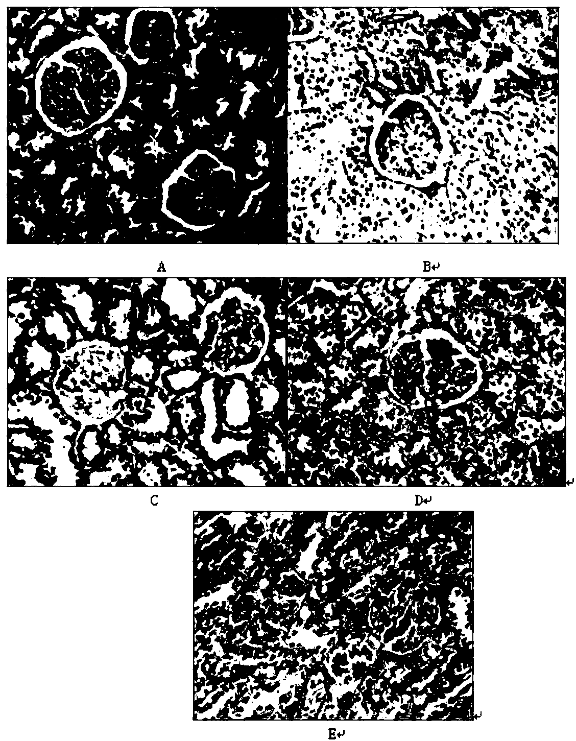 Traditional Chinese medicine composition for preventing and treating diabetic nephropathy and preparation method thereof