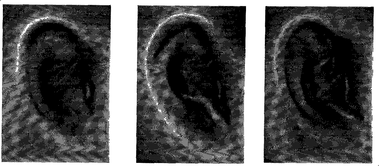 Method for extracting human ear image edge combining multiple methods