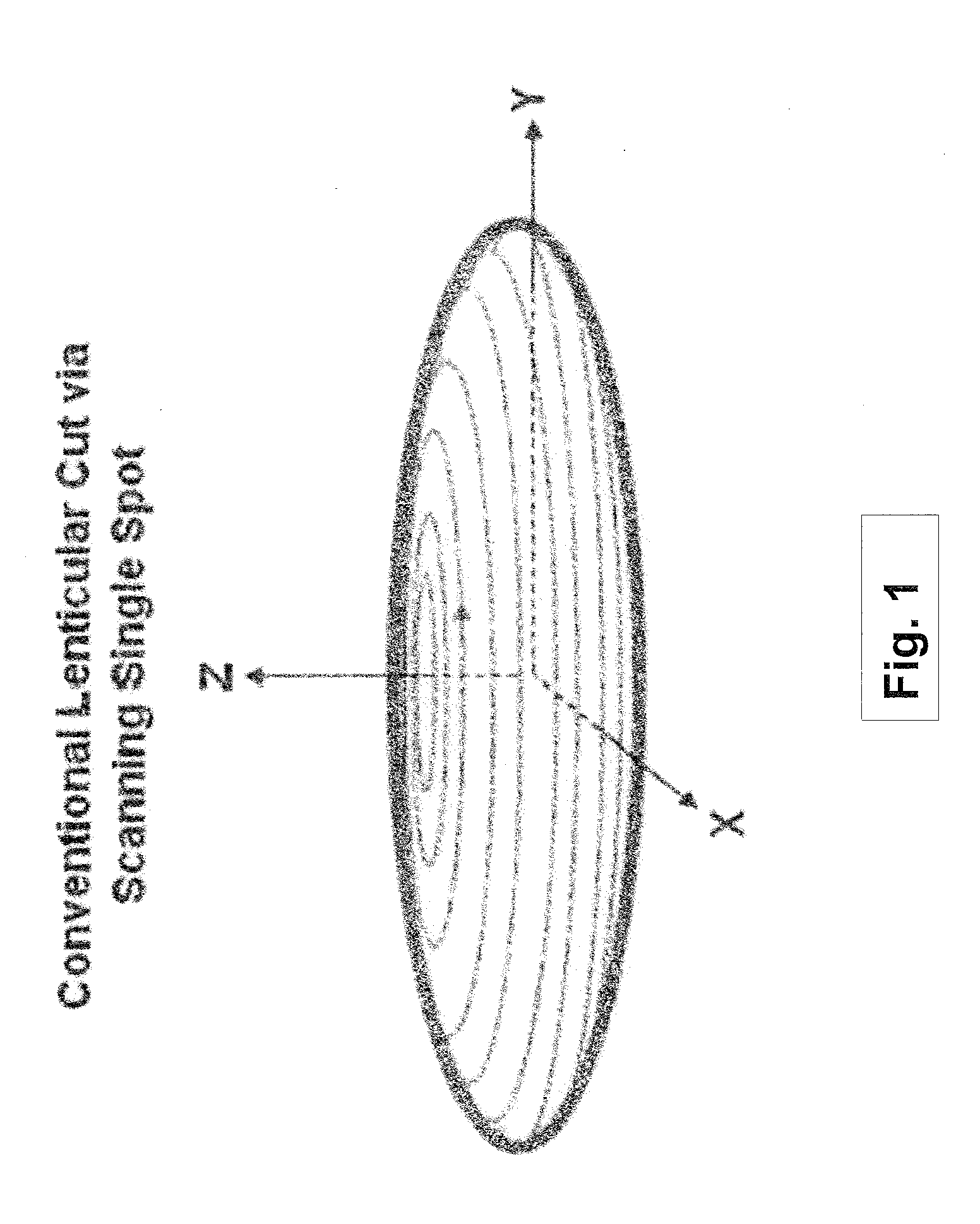 Systems and methods for lenticular laser incision