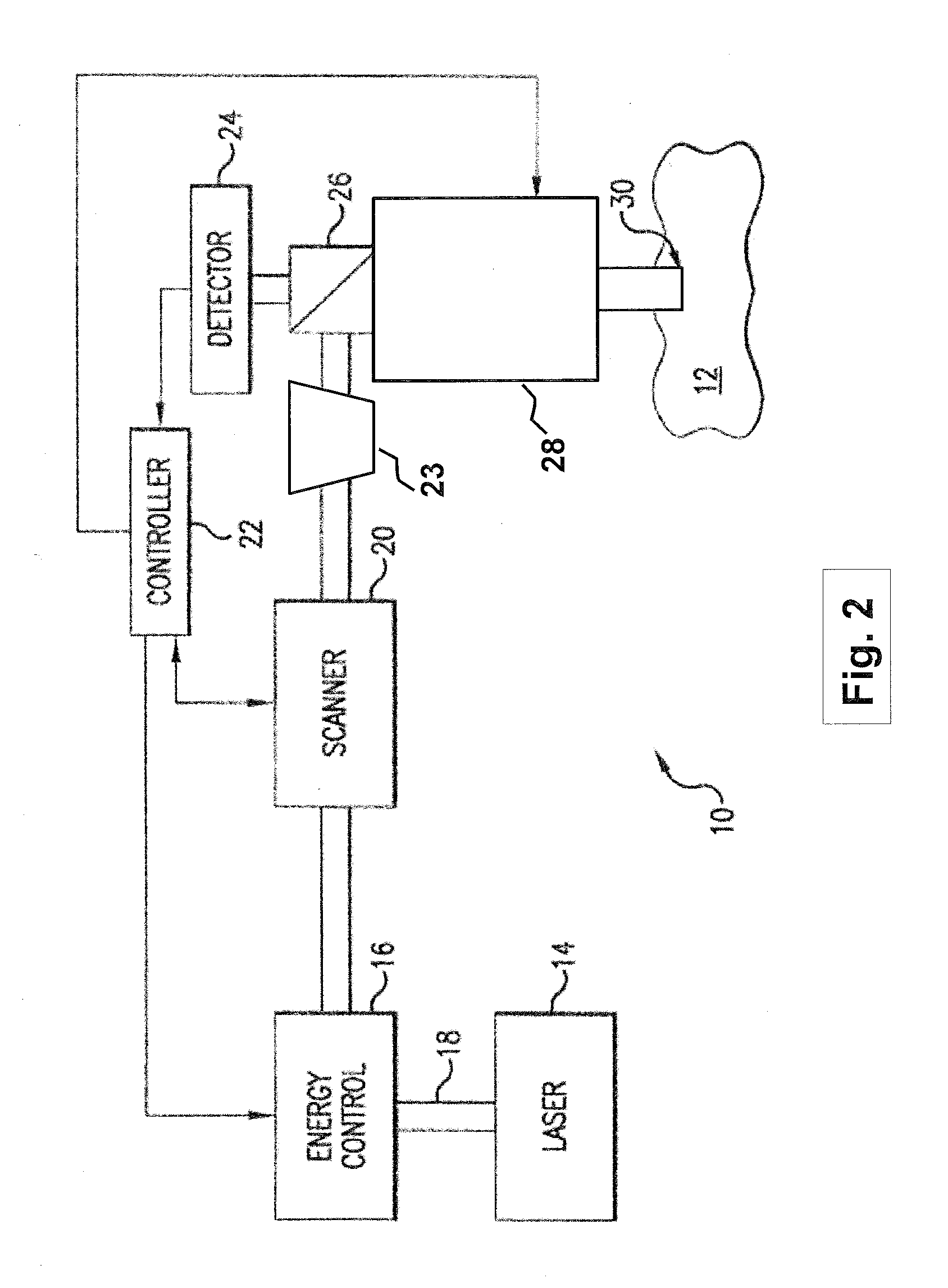 Systems and methods for lenticular laser incision