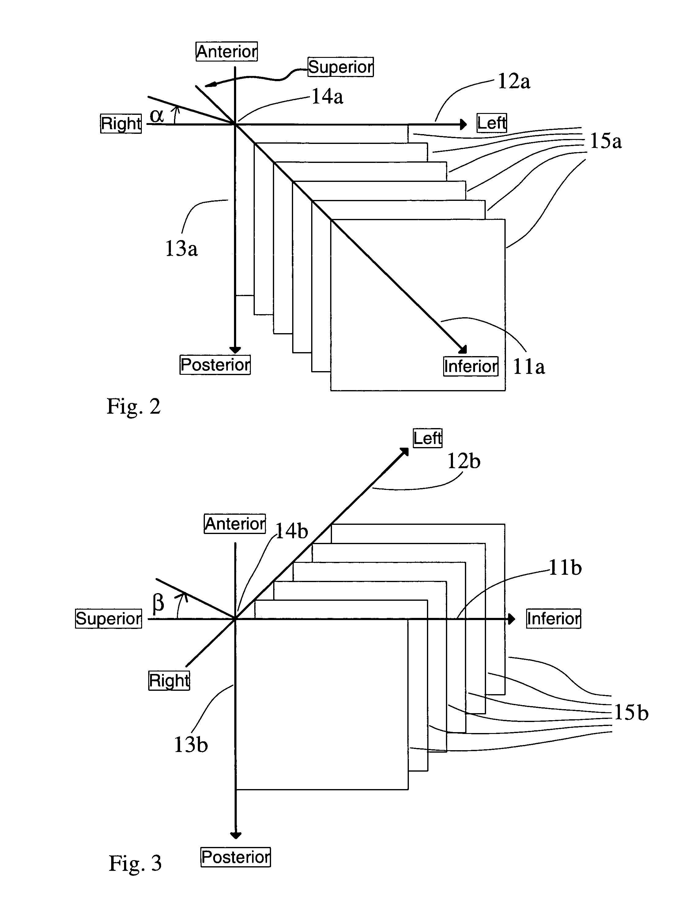 Method for assisted beam selection in radiation therapy planning