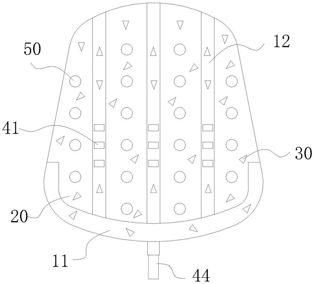 Absorbable gasket for high tibial osteotomy