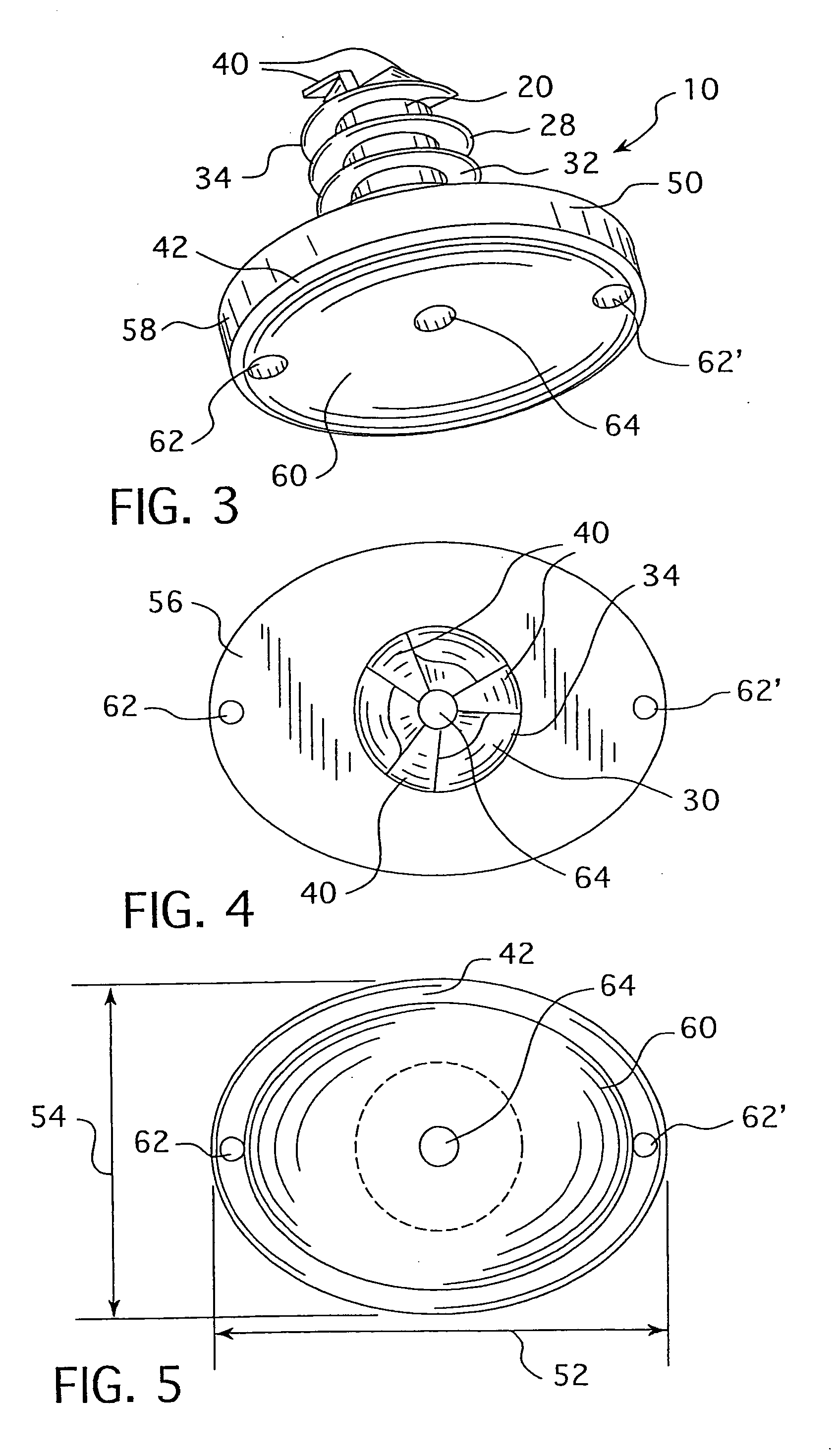 Cannulated hemi-implant and methods of use thereof
