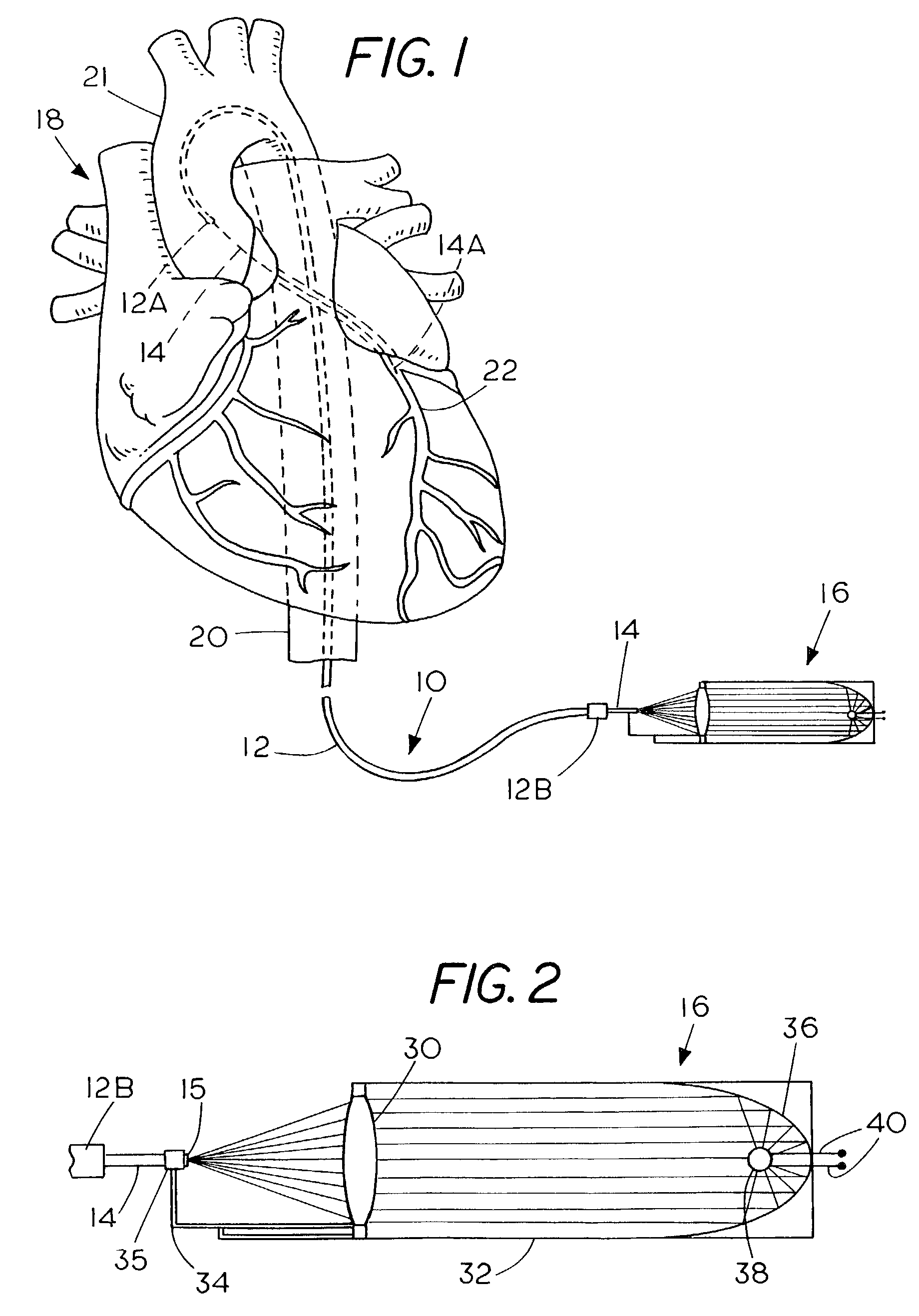 Apparatus and method for treating atherosclerotic vascular disease through light sterilization