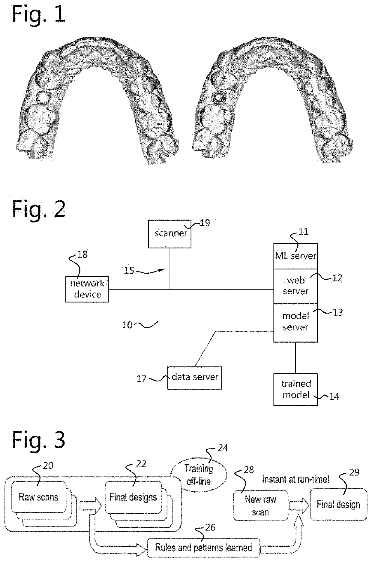 Method, system and devices for instant automated design of a customized dental object