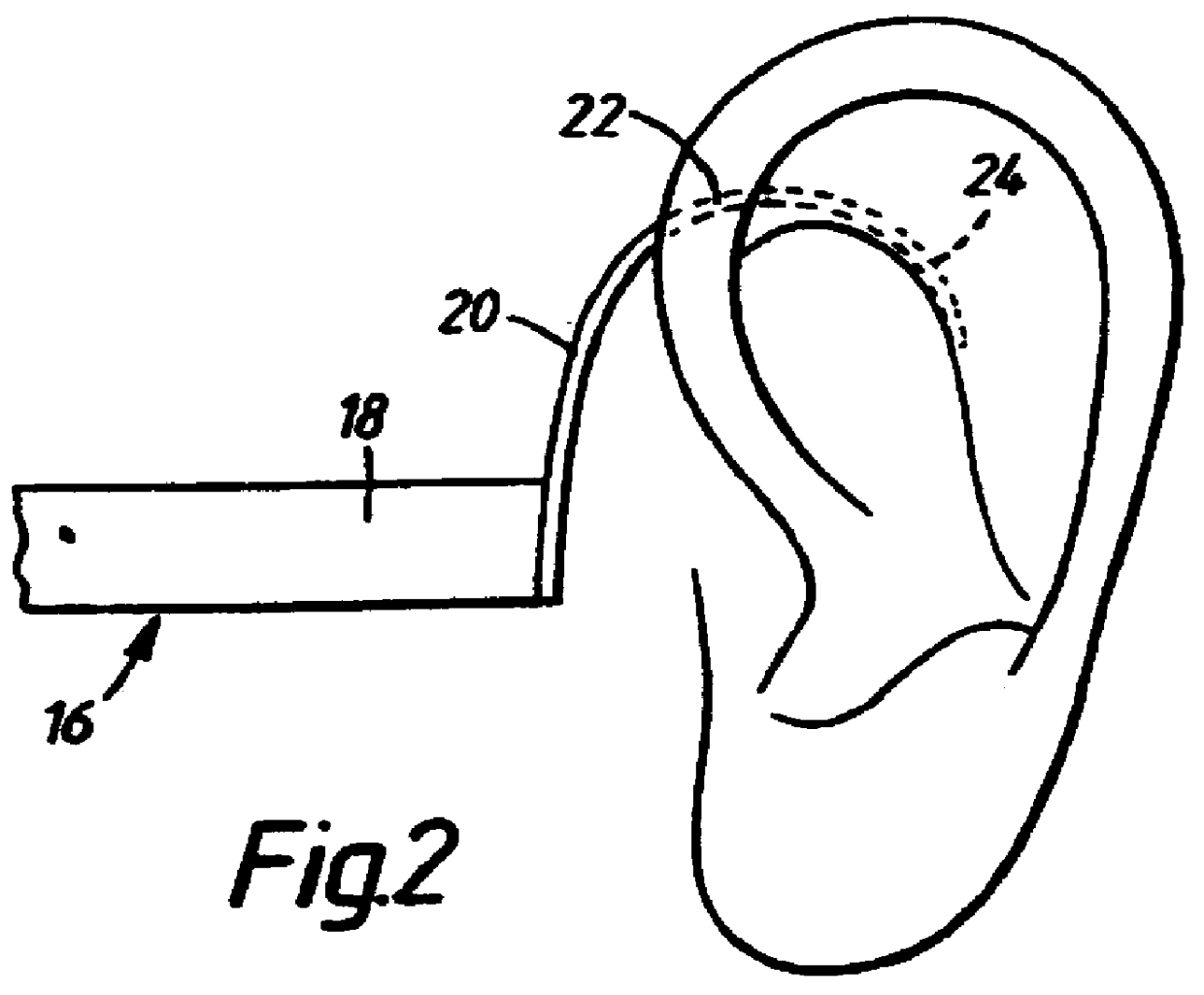 Magnifying spectacles