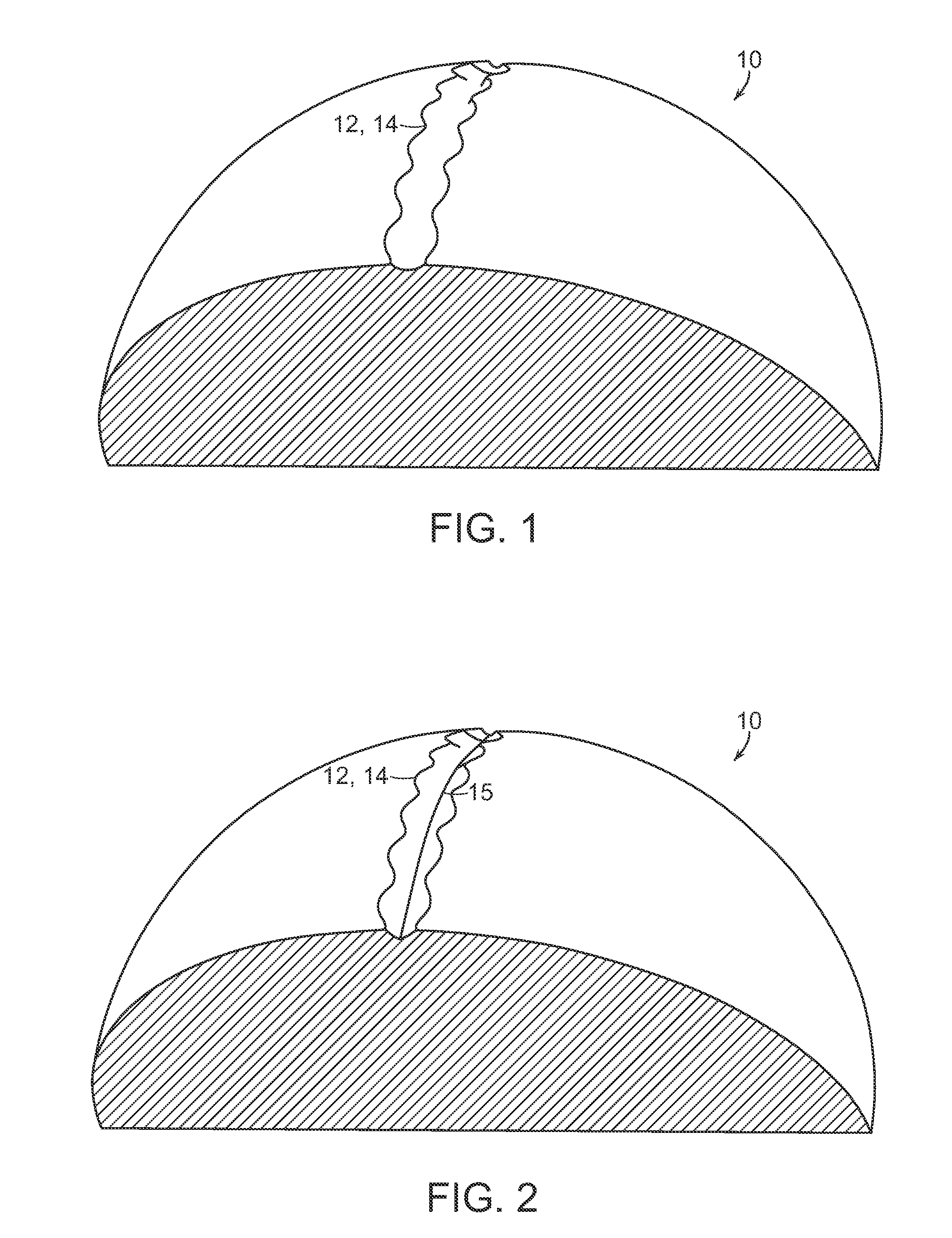 Golf ball surface patterns comprising a channel system