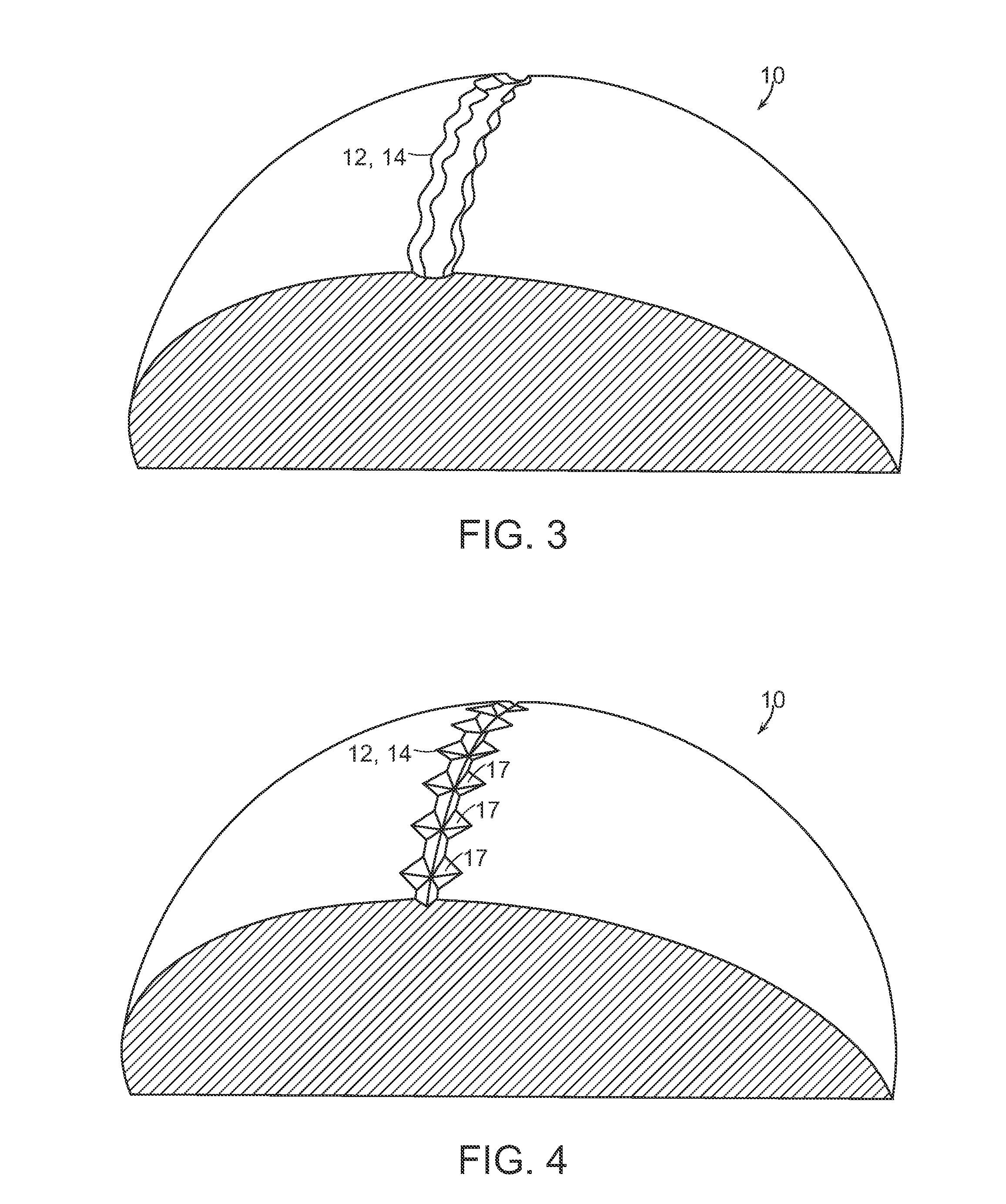 Golf ball surface patterns comprising a channel system