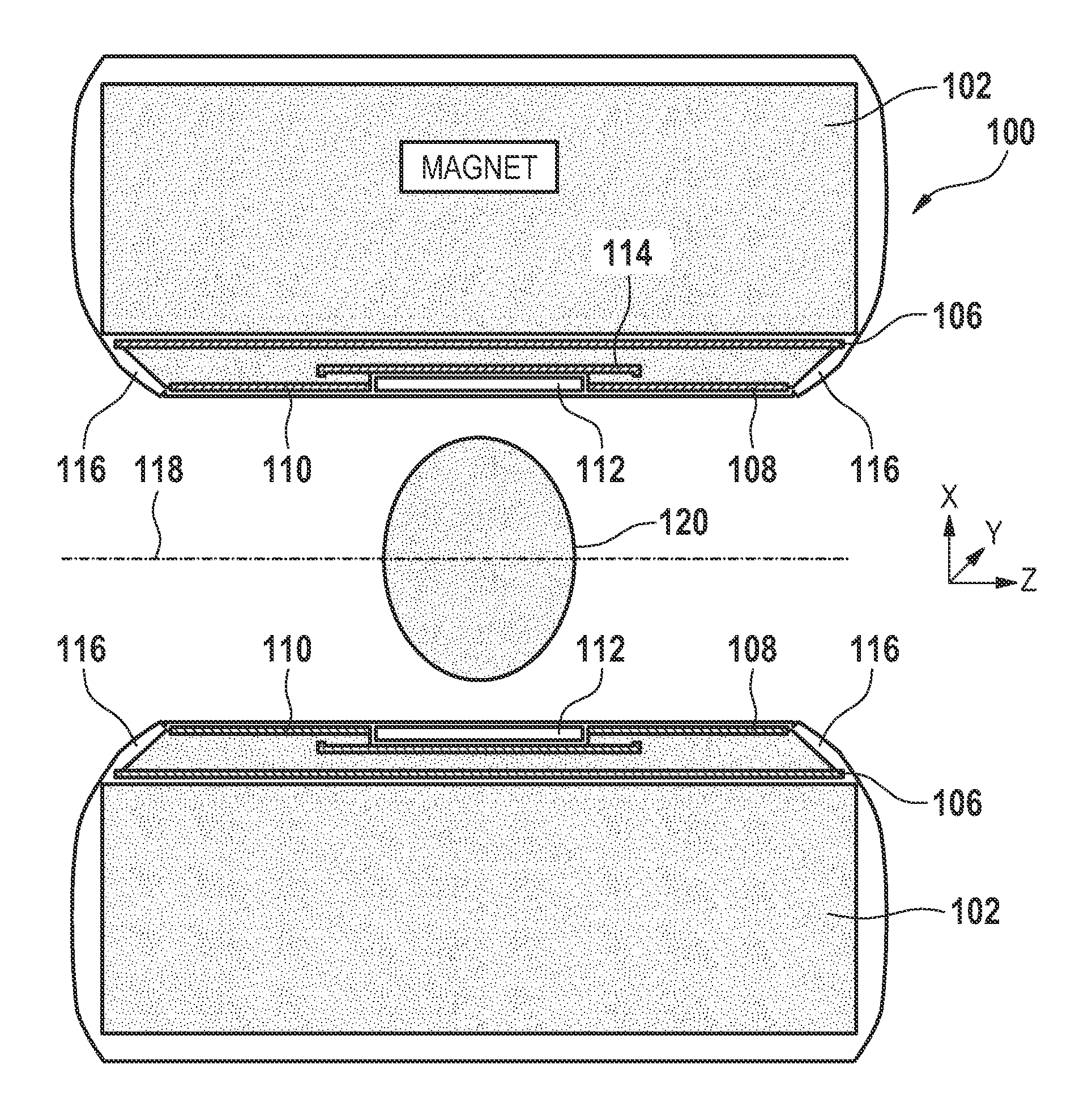 Magnetic resonance imaging system with satellite gradient coils