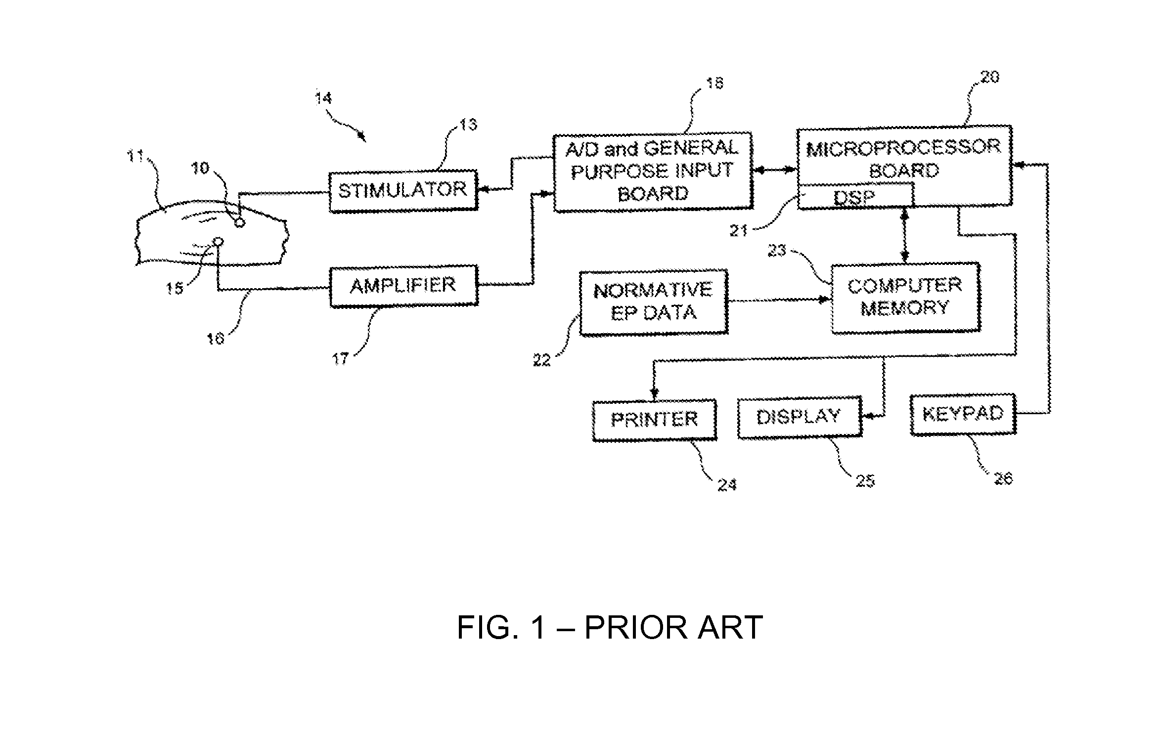 Device for recording ultrasound-induced fetal eeg, and method of use