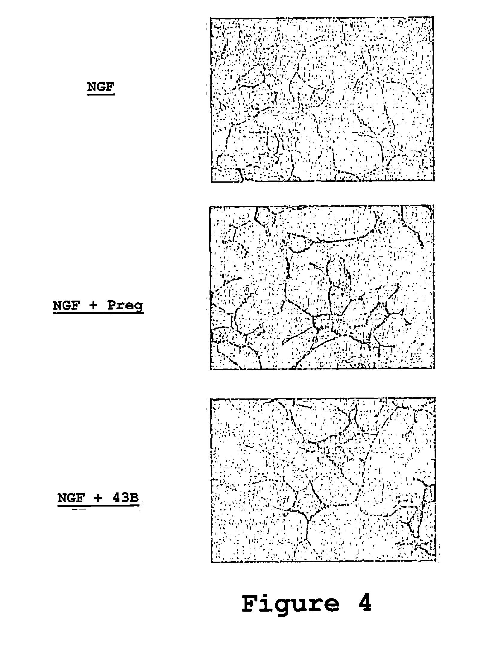 The use of 3-methoxy-pregnenolone for the preparation of a drug for treating a traumatic brain injury