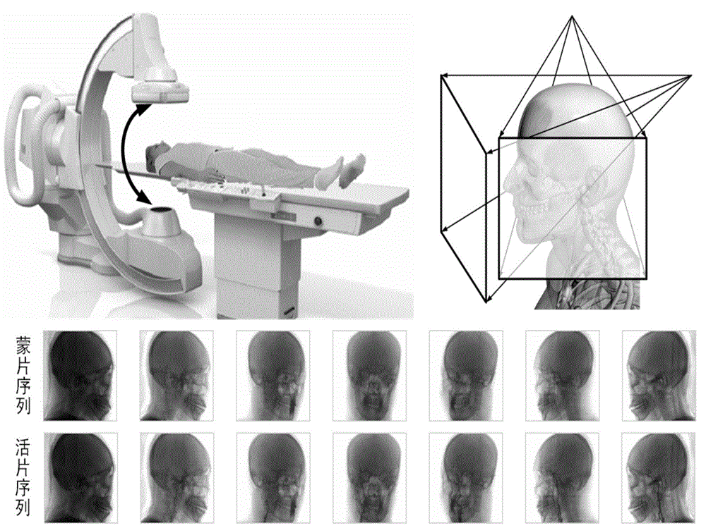Cerebrovascular image segmentation method based on multi-angle serialized image space feature point set