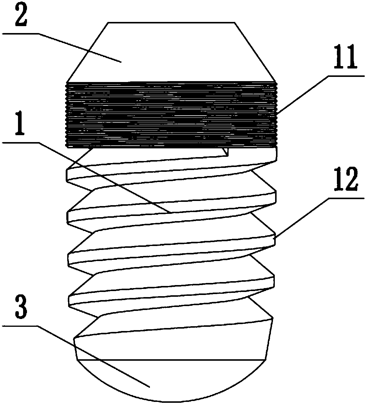 Oral implant