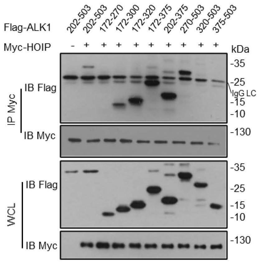 Application of a kind of hoip inhibitor for preparing medicine for treating type II human telangiectasia