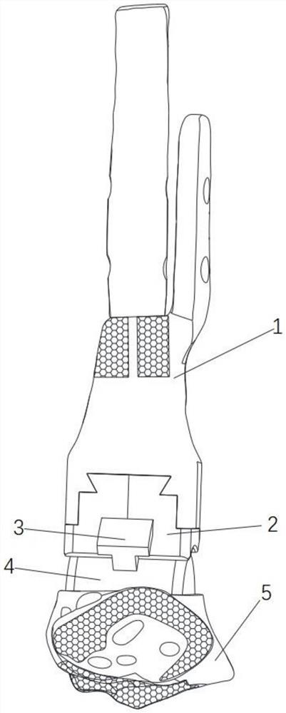 Device for customized 3D printing of ankle joints