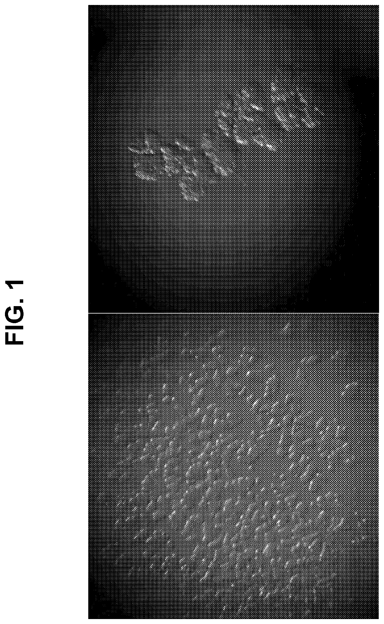 Buffered formulations of exendin (9-39)