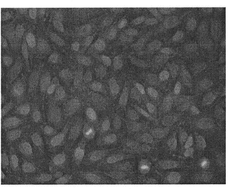 Preparation method and application of a drug-loaded magnetic composite nanomaterial