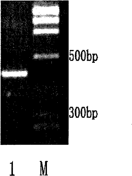 (+) gamma-lactamase with activity on splitting racemate gamma-lactam as well as coded gene and application thereof