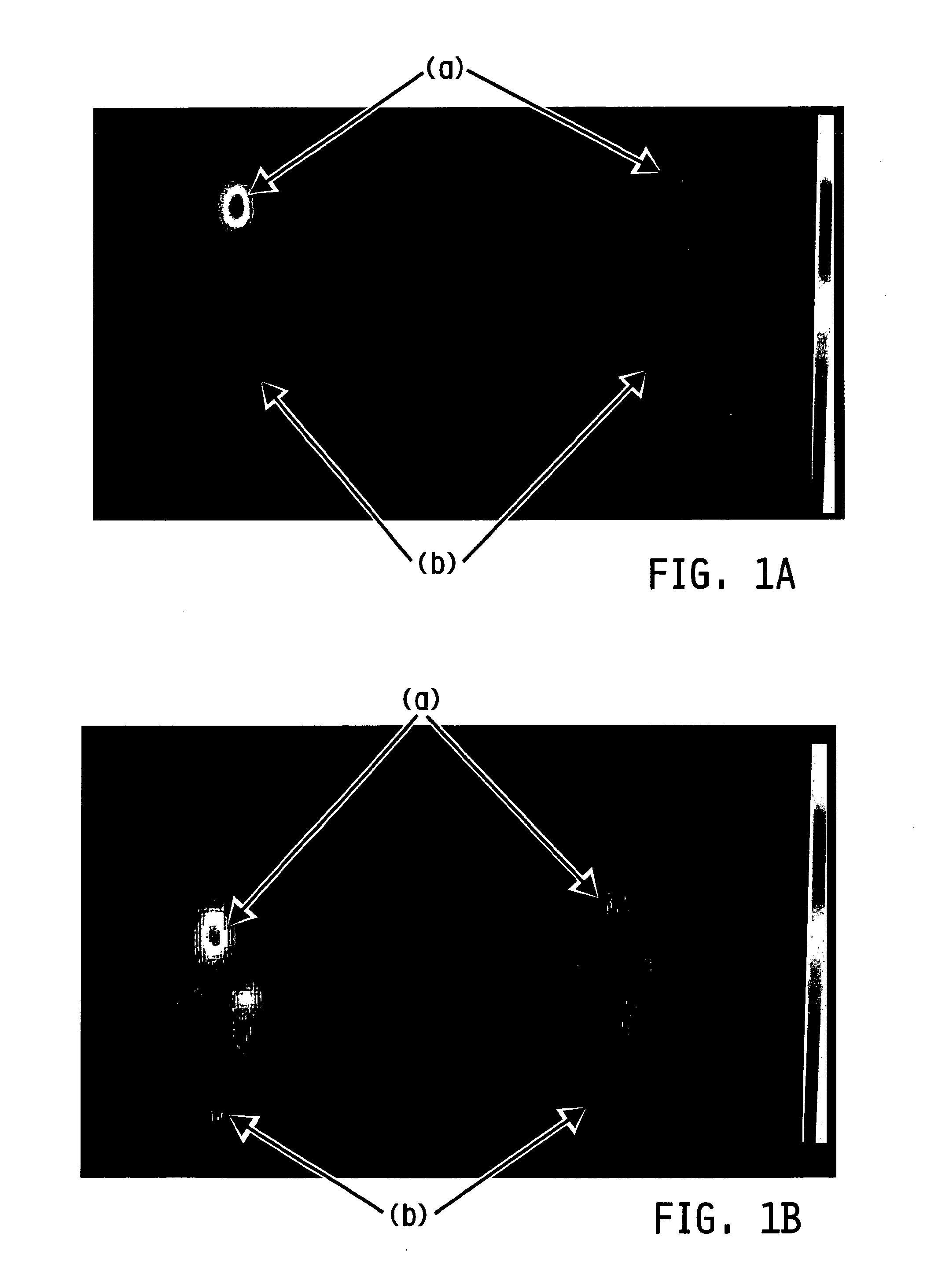 Method of imaging localized infections